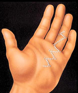 hand_surgery-5